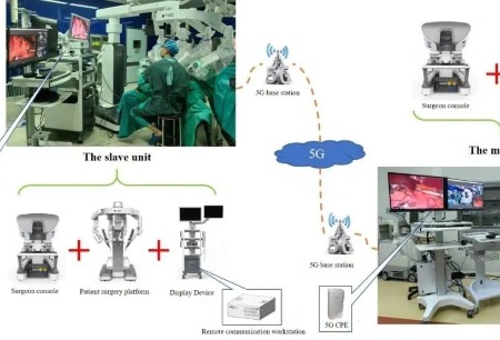 Intelligent Surgery論文推薦丨5G遠(yuǎn)程機(jī)器人手術(shù)，開創(chuàng)胃癌治療的新時(shí)代